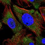 ARHGEF9 Polyclonal Antibody