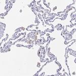 FCGR3A Antibody in Immunohistochemistry (Paraffin) (IHC (P))