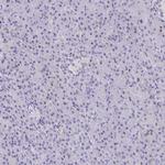 FCGR3A Antibody in Immunohistochemistry (Paraffin) (IHC (P))