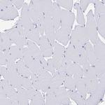 FCGR3A Antibody in Immunohistochemistry (Paraffin) (IHC (P))