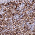 FCGR3A Antibody in Immunohistochemistry (Paraffin) (IHC (P))