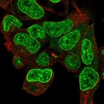 Carboxypeptidase D Polyclonal Antibody