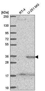 SPRY4 Antibody in Western Blot (WB)