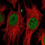 BAP1 Antibody in Immunocytochemistry (ICC/IF)
