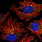 CARD10 Polyclonal Antibody