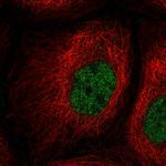 PPIL2 Polyclonal Antibody