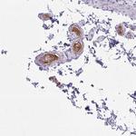 Heparin Cofactor II Antibody in Immunohistochemistry (Paraffin) (IHC (P))