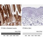 PYGM Polyclonal Antibody