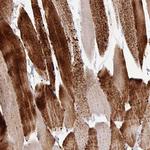 PYGM Antibody in Immunohistochemistry (Paraffin) (IHC (P))