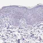 PYGM Antibody in Immunohistochemistry (Paraffin) (IHC (P))