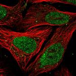 MNAR Polyclonal Antibody