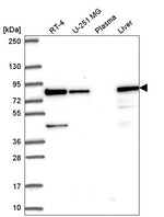 HADHA Antibody in Western Blot (WB)