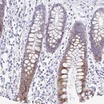 PIGK Polyclonal Antibody