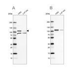 SRPK1 Antibody in Western Blot (WB)
