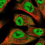 Protein Kinase D2 Polyclonal Antibody