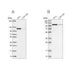 Protein Kinase D2 Antibody in Western Blot (WB)