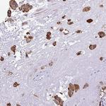 PIGK Polyclonal Antibody