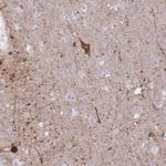 GRB7 Antibody in Immunohistochemistry (Paraffin) (IHC (P))