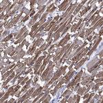 CRYAB Antibody in Immunohistochemistry (Paraffin) (IHC (P))