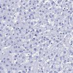 CRYAB Antibody in Immunohistochemistry (Paraffin) (IHC (P))