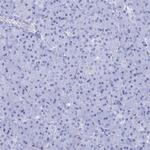 CRYAB Antibody in Immunohistochemistry (Paraffin) (IHC (P))