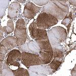 CRYAB Antibody in Immunohistochemistry (Paraffin) (IHC (P))