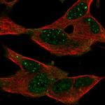 GPR155 Antibody in Immunocytochemistry (ICC/IF)