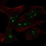 n-Myc Polyclonal Antibody