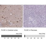 PLCB1 Polyclonal Antibody