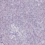 PLCB1 Antibody in Immunohistochemistry (Paraffin) (IHC (P))
