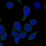 NCF4 Polyclonal Antibody