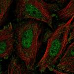 KLF11 Polyclonal Antibody