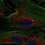 NPTX2 Polyclonal Antibody