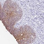 ZFP64 Antibody in Immunohistochemistry (Paraffin) (IHC (P))