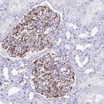 SMAD5 Antibody in Immunohistochemistry (Paraffin) (IHC (P))