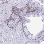 SMAD5 Antibody in Immunohistochemistry (Paraffin) (IHC (P))