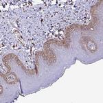 SMAD5 Antibody in Immunohistochemistry (Paraffin) (IHC (P))