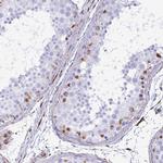 SMAD5 Antibody in Immunohistochemistry (Paraffin) (IHC (P))