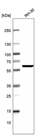 SMAD5 Antibody in Western Blot (WB)