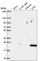 p27 Kip1 Antibody in Western Blot (WB)