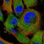 ZC3HAV1 Polyclonal Antibody