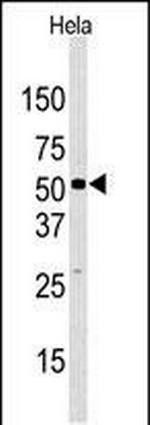 JMJD2D Polyclonal Antibody