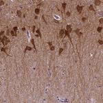 PRRT1 Polyclonal Antibody