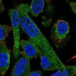 PPP2R5A Polyclonal Antibody