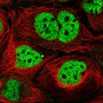 N4BP2L2 Polyclonal Antibody