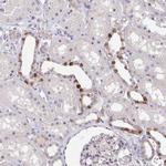 HOXD12 Antibody in Immunohistochemistry (Paraffin) (IHC (P))