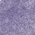 HOXD12 Antibody in Immunohistochemistry (Paraffin) (IHC (P))