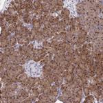 HOXD12 Polyclonal Antibody