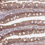 HOXD12 Antibody in Immunohistochemistry (Paraffin) (IHC (P))