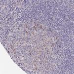 LTK Antibody in Immunohistochemistry (Paraffin) (IHC (P))